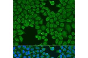 Immunofluorescence analysis of U2OS cells using AGGF1 Polyclonal Antibody at dilution of 1:100. (AGGF1 antibody)
