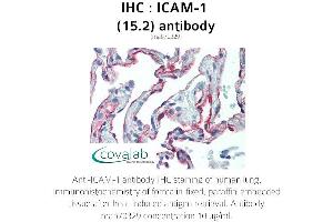 Image no. 1 for anti-Intercellular Adhesion Molecule 1 (ICAM1) antibody (ABIN1723250) (ICAM1 antibody)