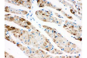 Anti- CPT1B Picoband antibody, IHC(P) IHC(P): Rat Cardiac Muscle Tissue (CPT1B antibody  (N-Term))