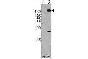 Western blot analysis of PDGFRA antibody and293 cell lysate (2 ug/lane) either nontransfected (Lane 1) or transiently transfected with the human gene (2). (PDGFRA antibody  (AA 746-775))
