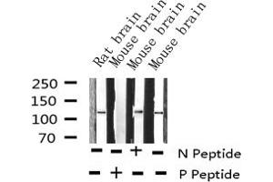 Western blot analysis of Phospho-Retinoblastoma (Ser807) expression in various lysates (Retinoblastoma 1 antibody  (pSer807))