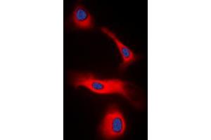 Immunofluorescent analysis of LT beta staining in HeLa cells. (LTB antibody  (C-Term))