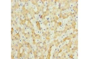 Immunohistochemistry of paraffin-embedded human liver tissue using ABIN7151803 at dilution of 1:100 (ECHS1 antibody  (AA 28-290))