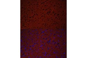 Immunofluorescence analysis of rat brain using STXBP1 antibody (ABIN6128255, ABIN6148673, ABIN6148674 and ABIN6221073) at dilution of 1:50. (STXBP1 antibody  (AA 295-594))