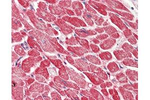 Anti-AK1 / Adenylate Kinase 1 antibody IHC staining of human heart. (Adenylate Kinase 1 antibody  (AA 108-157))