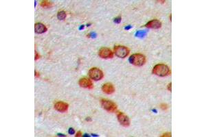 Immunohistochemical analysis of CaMK2 alpha/delta (pT286) staining in human brain formalin fixed paraffin embedded tissue section. (CaMK2 alpha/delta antibody  (pSer286))