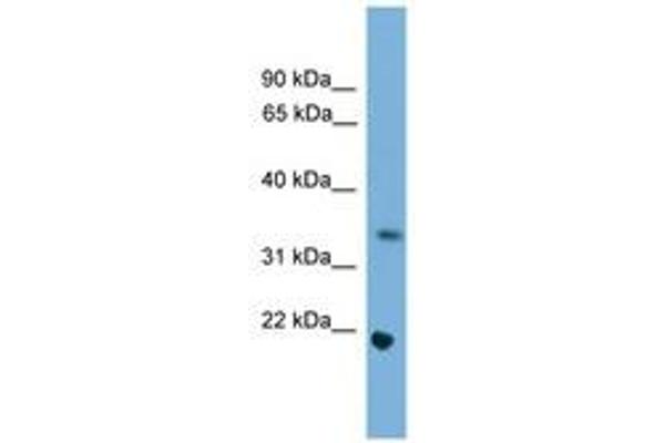 SOHLH1 anticorps  (AA 121-170)