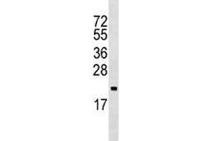 ARF5 antibody western blot analysis in Ramos lysate (ARF5 antibody  (AA 80-108))