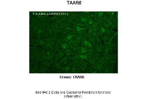 Researcher: Timur Mavlyutov, Ph. (TAAR6 antibody  (C-Term))