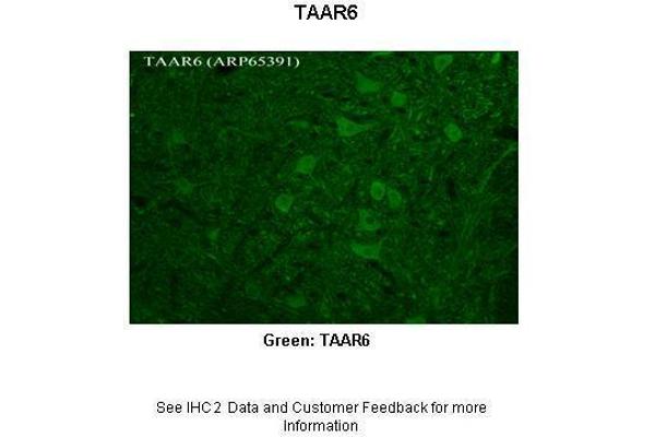 TAAR6 anticorps  (C-Term)