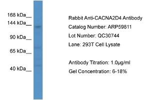 WB Suggested Anti-CACNA2D4  Antibody Titration: 0. (CACNA2D4 antibody  (C-Term))