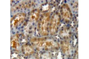 Used in DAB staining on fromalin fixed paraffin-embedded Kidney tissue (LGALS8 antibody  (AA 151-316))