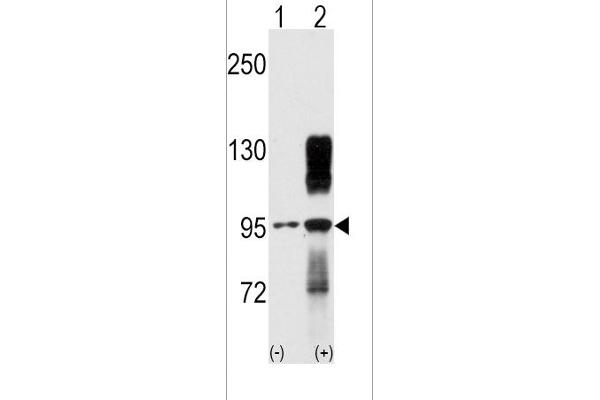 DDR2 antibody