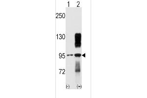 Western blot analysis of TYRO10 (arrow) using rabbit polyclonal TYRO10 Antibody (ABIN392069 and ABIN2841832).
