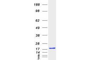 UBE2L3 Protein (Transcript Variant 1) (Myc-DYKDDDDK Tag)