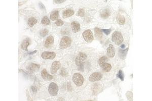 Immunohistochemistry (IHC) image for anti-Forkhead Box P1 (FOXP1) (AA 627-677) antibody (ABIN7448572)