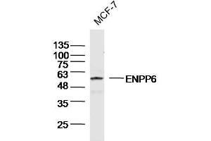 MCF-7 Cell lysates probed with ENPP6 Polyclonal Antibody, unconjugated (bs-13076R) at 1:300 overnight at 4°C followed by a conjugated secondary antibody for 60 minutes at 37°C. (ENPP6 antibody  (AA 251-350))