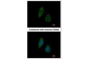 ICC/IF Image Immunofluorescence analysis of methanol-fixed HeLa, using BMP4, antibody at 1:200 dilution. (BMP4 antibody  (C-Term))