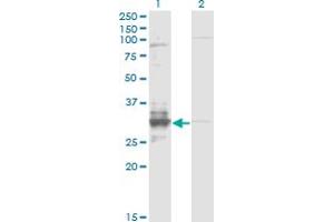 Western Blot analysis of TFPI2 expression in transfected 293T cell line by TFPI2 monoclonal antibody (M01), clone 3E8. (TFPI2 antibody  (AA 1-235))