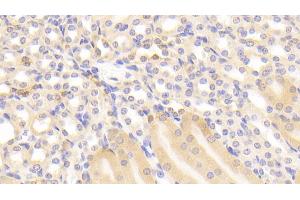 Detection of GSTp in Mouse Kidney Tissue using Polyclonal Antibody to Glutathione S Transferase Pi (GSTp) (GSTP1 antibody  (AA 1-210))