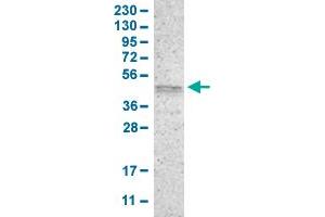 Western Blot analysis of human cell line RT-4 with PRKX polyclonal antibody .