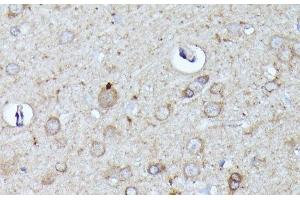 Immunohistochemistry of paraffin-embedded Rat brain using N-WASP Polyclonal Antibody at dilution of 1:100 (40x lens). (Neural Wiskott-Aldrich syndrome protein (WASL) antibody)