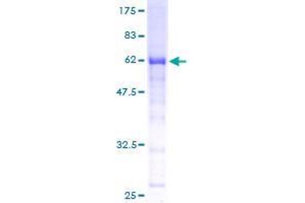 RPRD1B Protein (AA 1-326) (GST tag)