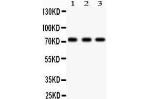 Anti- p73 antibody, Western blotting All lanes: Anti p73  at 0. (Tumor Protein p73 antibody  (AA 1-198))