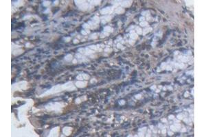 DAB staining on IHC-P; Samples: Mouse Colon Tissue (TOPBP1 antibody  (AA 1-246))