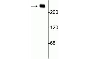 Western blot of rat hippocampal lysate showing specific immunolabeling of the ~240 kDa alpha II spectrin protein. (SPTAN1 antibody)