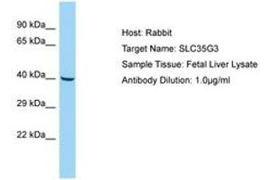 Image no. 1 for anti-Solute Carrier Family 35, Member G3 (SLC35G3) (AA 22-71) antibody (ABIN6750150) (SLC35G3 antibody  (AA 22-71))