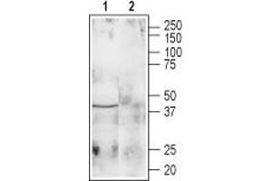 Galanin Receptor 1 antibody  (1st Extracellular Loop)