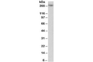 Western blot testing of Jurkat lysate with MYO5A antibody at 1ug/ml. (MYO5A antibody)
