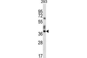Western Blotting (WB) image for anti-Olfactory Receptor, Family 9, Subfamily K, Member 2 (OR9K2) antibody (ABIN2996627)