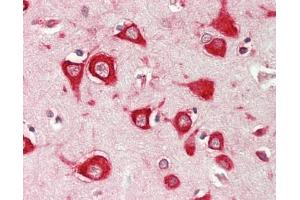 Human Brain, Cortex: Formalin-Fixed, Paraffin-Embedded (FFPE). (TTC15 antibody  (AA 579-608) (HRP))
