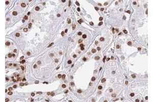 ABIN6267014 at 1/100 staining human kidney tissue sections by IHC-P. (CTBP1 antibody  (pSer422))