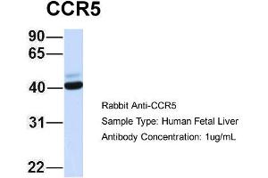 Host: Rabbit Target Name: CCR5 Sample Type: Human Fetal Liver Antibody Dilution: 1. (CCR5 antibody  (Middle Region))