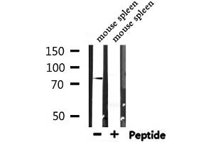 Western blot analysis of extracts from mouse spleen, using ZYX  Antibody. (ZYX antibody  (Internal Region))