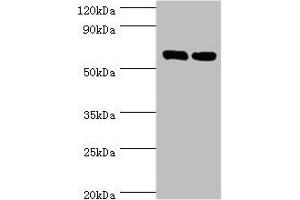 Western blot All lanes: TROVE2 antibody at 2 μg/mL Lane 1: Hela whole cell lysate Lane 2: 293T whole cell lysate Secondary Goat polyclonal to rabbit IgG at 1/10000 dilution Predicted band size: 61, 24, 59, 60 kDa Observed band size: 61 kDa
