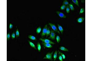 Immunofluorescent analysis of A549 cells using ABIN7172859 at dilution of 1:100 and Alexa Fluor 488-congugated AffiniPure Goat Anti-Rabbit IgG(H+L) (TRPM2 antibody  (AA 60-119))