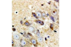 Immunohistochemical analysis of Complement C1QA staining in mouse brain formalin fixed paraffin embedded tissue section.