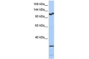 WB Suggested Anti-OSMR Antibody Titration:  0. (Oncostatin M Receptor antibody  (Middle Region))