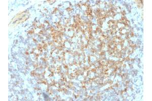 Immunohistochemistry (IHC) image for anti-Integrin beta 3 (ITGB3) (AA 385-490) antibody (ABIN6939826)