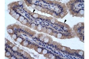 SMPDL3B antibody was used for immunohistochemistry at a concentration of 4-8 ug/ml to stain Epithelial cells of intestinal vilIus (arrows) in Human Intestine.