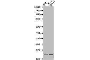 Western blot analysis of 293T mouse-spleen lysis using Acetyl-Histone H3 (K9) antibody. (HIST1H3A/HIST2H3A/H3F3A (acLys9) antibody)
