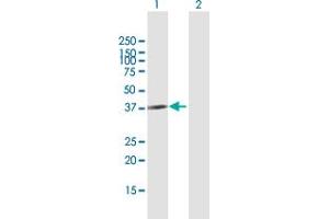 Western Blot analysis of CBX4 expression in transfected 293T cell line by CBX4 MaxPab polyclonal antibody. (CBX4 antibody  (AA 1-290))