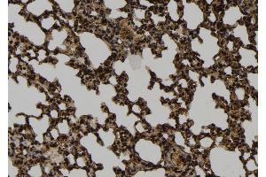 ABIN6274040 at 1/100 staining Mouse lung tissue by IHC-P. (PRC1 antibody  (Internal Region))