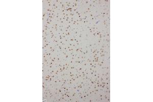 Anti-PDK2 antibody, IHC(P) IHC(P): Rat Brain Tissue (PDK2 antibody  (C-Term))