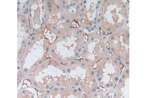 Used in DAB staining on fromalin fixed paraffin- embedded kidney tissue (MPP2 antibody  (AA 345-573))