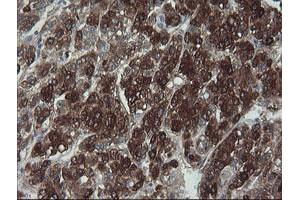 Immunohistochemistry (IHC) image for anti-Formiminotransferase Cyclodeaminase (FTCD) antibody (ABIN1496377) (FTCD antibody)